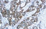 Anti-p120 Catenin CE/IVD for IHC - Gynecological pathology