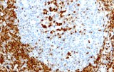 Anti-p27 KIP1 CE/IVD for IHC - Gynecological pathology