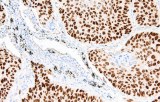 Anti-p40 CE/IVD for IHC - Dermopathology