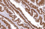 Anti-p53 CE/IVD for IHC - Genitourinary pathology