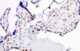 Anti-p57kip2 CE/IVD for IHC - Genitourinary pathology