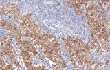 Anti-Podoplanin CE/IVD for IHC - Dermopathology