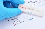 SARS-CoV-2 - Products for diagnosis - Rapid tests