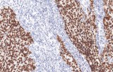 Anti-SALL4 CE/IVD for IHC - Genitourinary pathology