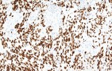 Anti-SOX10 CE/IVD for IHC - Dermopathology