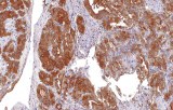 Anti-Thyroglobulin CE/IVD for IHC - Head and neck pathology