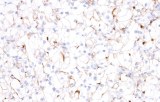 Anti-TIM3 CE/IVD for IHC - Hematopathology