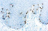 Anti-Tyrosinase CE/IVD for IHC - Dermopathology