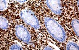 Anti-Vimentin CE/IVD for IHC - Neuropathology