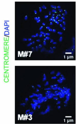 Costaining of chromosomes (DAPI, blue) and centromeres (cat. 15-234, 1:250; green) in representative nuclei of metaphase short-term cultures, established from Nf2KO-Setd2KO-Trp53KO-4q9p21 tumor-bearing mice. Image from publication CC-BY-4.0. PMID:37365326
