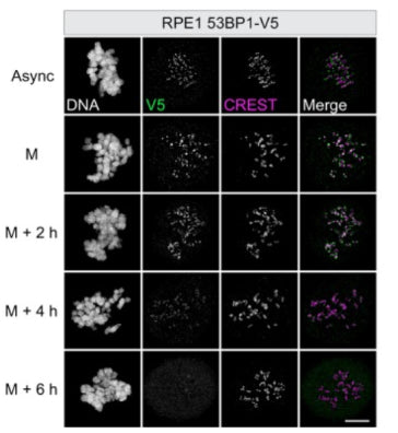 RPE1 53BP1‐V5 cells were either left untreated (async = asynchronous) or synchronized in prometaphase in medium containing nocodazole, fixed immediately (M = mitosis) or after 2, 4, or 6 h and co‐stained with V5 and CREST (cat. 15-234, 1:500). Image from publication CC-BY-4.0. PMID:37888778