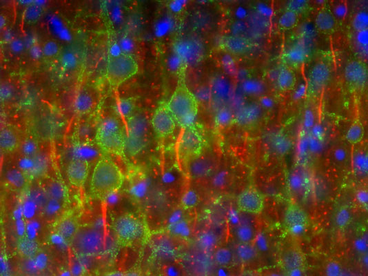 Immunofluorescence staining of adult rat cortex with N419/40 (red), K89/34 (green) and Hoechst nuclear stain (blue).