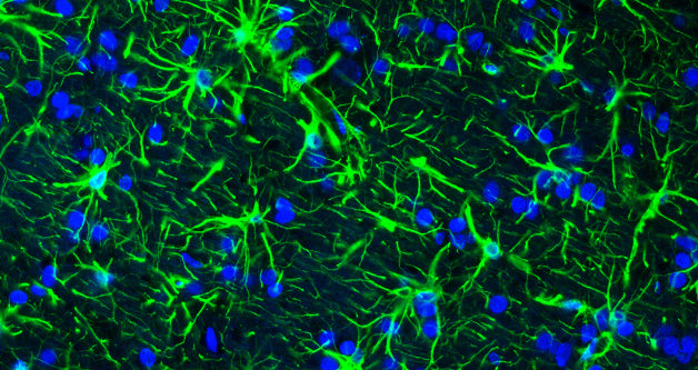 Representative section of formalin fixed, paraffin-embedded rat brain showing staining of GFAP. The sections were stained with Aves Labs anti-GFAP antibody (visualized in green) (Cat. No. GFAP) at 1:500 dilution. The stained sections were mounted with Antibodies Incorporated FluoroshieldTM with DAPI and DABCO mounting medium (Cat No. AR-6505). DAPI nuclear stain (blue) shows cell nuclei. Anti-GFAP specifically stains the astrocytes in the rat brain.