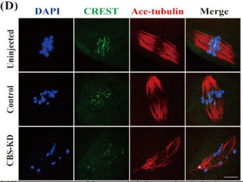 Uninjected, Control, CBS-KD human oocytes cultured in M16 medium for 8 h to MI for immunofluorescence with Mitotic arrest deficiency 1 (MAD1) (red) and human anti-centromere antibody (CREST) (green). Image from publication CC-BY-4.0. PMID: 36053797