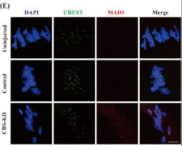 Human oocytes in Uninjected, Control, CBS-KD groups were cultured in M16 medium for 8 h to MI and then incubated on ice for 5 min and processed for immunofluorescence with acetylated α-tubulin (red) and CREST antibody (green). Image from publication CC-BY-4.0. PMID: 36053797
