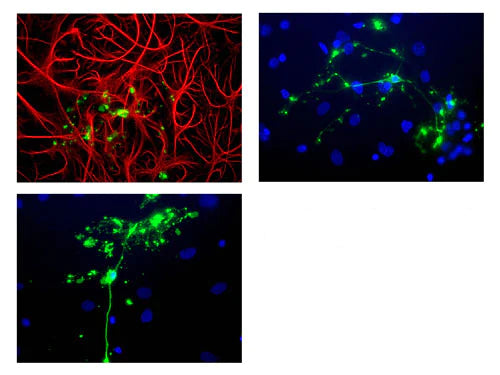 Chicken anti-Myelin Basic Protein (MBP) (green) and Mouse anti-GFAP (red) with nuclei stained with Hoechst dye (blue).