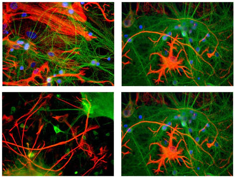Chicken anti-NSE (green) and mouse anti-GFAP (red).