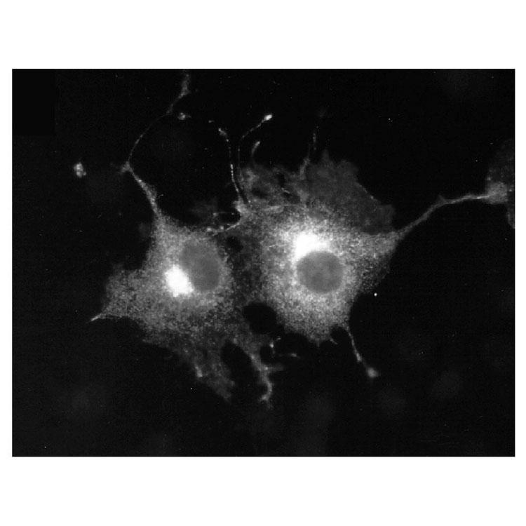 Immunofluorescence staining transiently Kv1.5-transfected COS cells.