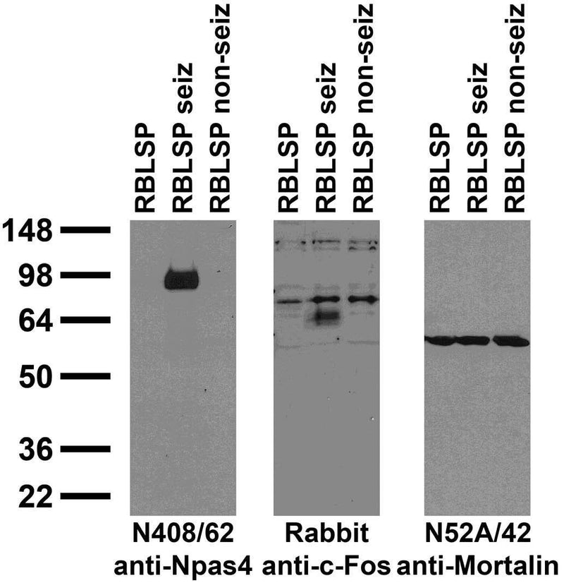 Immunoblot against crude brain low-speed pellets from untreated adult rats (RBLSP), adult rats treated with kainic acid to induce seizures (RBLSP seiz) and adult rats treated with saline (RBLSP non-seiz) probed with N408/62 (left) and N52A/42 (right) TC supe and with Rabbit anti-c-Fos (middle).