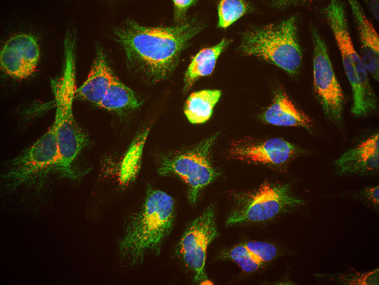 Immunostaining of HeLa cells showing specific, strong cytoplasmic labeling of LAMP1 (cat. 1030-LAMP1, red, 1:2000) corresponding to lysosomes and late endosomes. Additional staining with Anti-Vimentin (cat. 2105-VIM, green, 1:500) specifically labeling the intermediate filament network. The blue stain is DAPI to reveal nuclear DNA. 