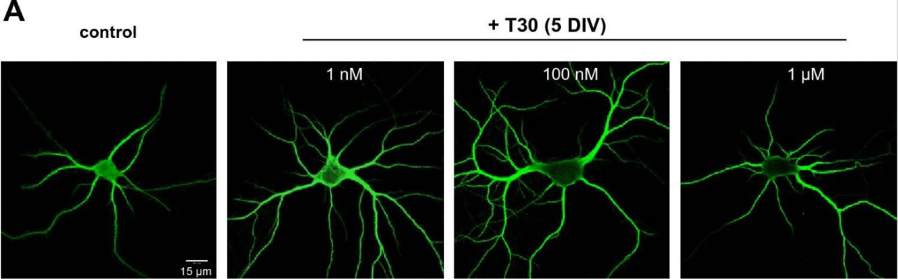 Representative images of anti-MAP2 (ca. 1100-MAP2) immunolabeled rat neurons at 5 DIV of T30 treatment. Image from publication CC-BY-4.0. PMID: 37454238