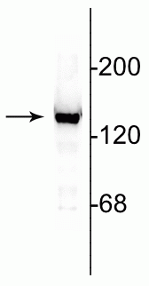 Western blot of 10 µg of rat cerebellar lysate showing specific immunolabeling of the ~140 kDa NR2C subunit of the NMDA receptor. 