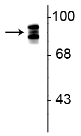 Western blot of rat lung lysate showing specific immunolabeling of the ~93 kDa periostin protein triplet. 