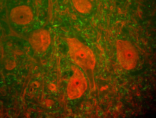Immunofluorescence of a section of rat spinal cord labeled with anti-UCHL1 (cat. 2060-UCHL1, 1:500, red) and anti-Neurofilament H (cat. 1451-NFH, 1:25,000, green). The large cells are alpha-motorneurons and UCHL1 fills the cytoplasm of their perikarya and dendrites.