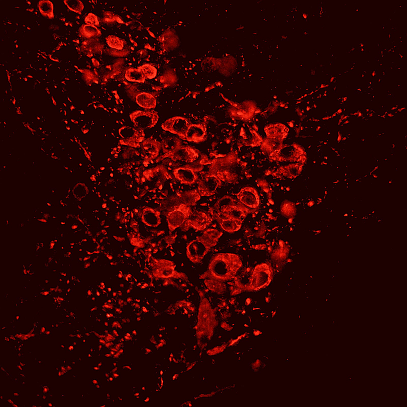 Immunostaining of free-floating sections of mouse locus ceruleus (brainstem) labeling tyrosine hydroxylase (Cat no 2027-THSHP, red, 1:2000) The mouse was transcardially perfused with 20 mL of PBS containing 0.1% procaine and 100 U/mL heparin followed by 20 mL of 4% paraformaldehyde (PFA) in PBS. The dissected brains were kept in fixative at 4 °C overnight. The image was kindly provided by Eugene Dimitrov, Department of Physiology and Biophysics, Rosalind Franklin University.