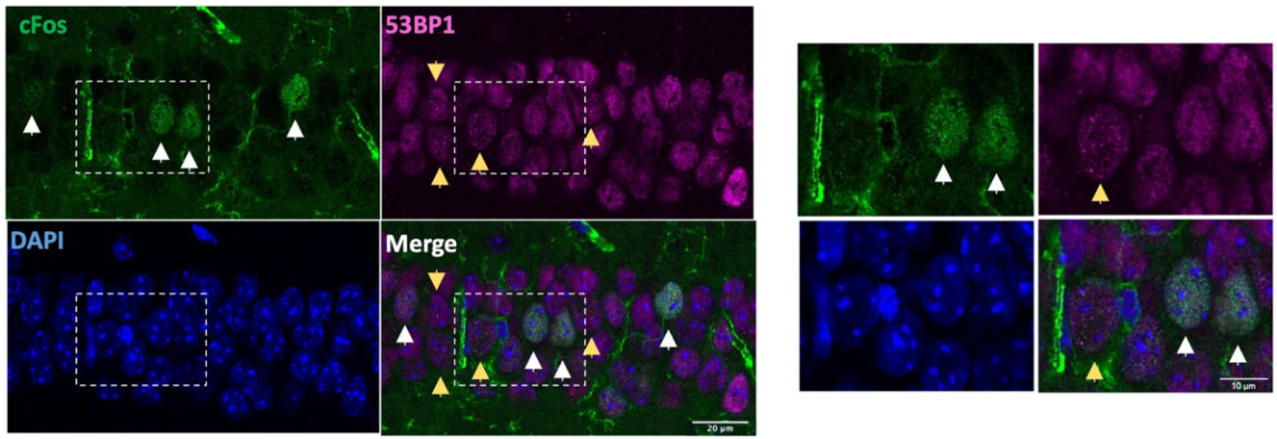Representative images of CA1 region of mouse hippocampus. White arrows indicate cFos+ cells (cat. 309-cFOS), yellow arrows indicate 53BP1 + cells. Nuclei stained with DAPI (blue). Right: zoomed images of the white boxes. Image from publication CC-BY-4.0. PMID: 36732588