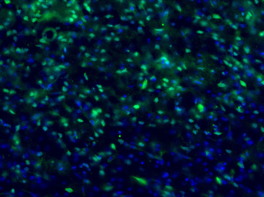 Immunostaining of mouse brain labeling c-Fos protein in green(cat. 309-cFOS, 1:1000) and DNA with DAPI. Photo courtesy of Adam Almeida, University of Colorado.