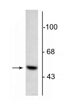 Western blot of 5 µg of bovine adrenal medulla lysate showing specific immunolabeling of the ~55 kDa DOPA decarboxylase protein.