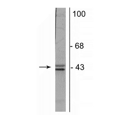 Western blot of postnatal day 3 rat brain lysate showing specific immunolabeling of the ~35 kDa and ~45 kDa doublecortin protein.