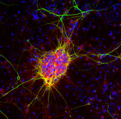 Immunofluorescence of rat cortical neuron-glial cells showing strong cytoplasmic labeling of a small population of developing neurons and their processes with Anti-DCX (cat. 451-DCX, 1:1000, red) while Anti-MAP2 (cat. 1100-MAP2, 1:10,000, green) labels dendrites and perikarya or mature neurons, and additional nuclear staining was done with DAPI (blue). Anti-doublecortin is an excellent marker of early developing neuronal cells.