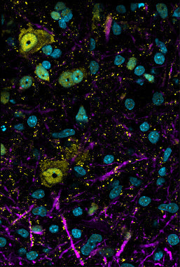 Cell Line: human-derived iPSC cerebral organoids. MAP2 (pink), NeuN (yellow), DAPI (turquoise). Image courtesy of Caroline Krall, Johns Hopkins University