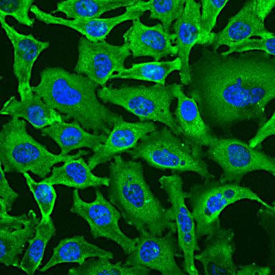Immunostaining of HeLa cells labeled with Anti-GAPDH(cat. 600-GAPDH, 1:100, green) and nuclear staining with DAPI (blue). The anti-GAPDH produces strong cytoplasmic labeling of healthy cells.