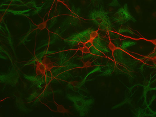 Immunolabeling of mouse hippocampal cultures labeled with Anti-GFAP (cat. 620-GFAP, 1:1000, green) and anti-MAP2 (1100-MAP2, 1:1000, red).