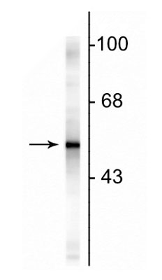 Western blot of rat cortical lysate showing specific immunolabeling of the ~50 kDa GFAP protein.
