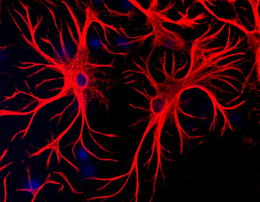 Immunolabeling of mixed neuron and glia cultures where astrocytes are strongly and specifically labeled with Anti-GFAP(cat. 621-GFAP, 1:1000, red), and nuclear staining with DAPI (blue).