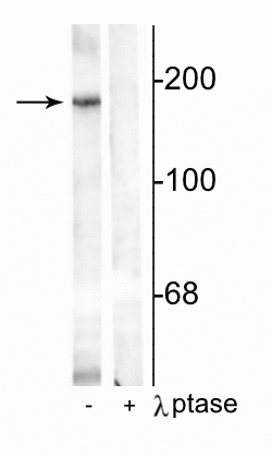 Western blot of rat hippocampal lysate showing specific immunolabeling of the ~180 kDa NR2B subunit phosphorylated at Tyr1336 in the first lane (-). Phosphospecificity is shown in the second lane (+) where immunolabeling is completely eliminated by blot treatment with lambda phosphatase (λ-Ptase, 1200 units for 30 min). 