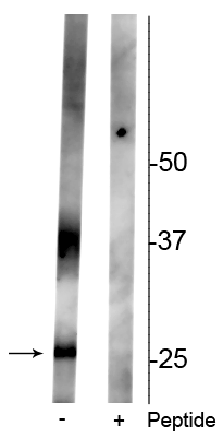 Western blot of rat kidney lysate showing specific immunolabeling of the ~29 kDa and 37 kDa glycosylated form of the AQP2 protein phosphorylated at Ser261 in the first lane (-). Phosphospecificity is shown in the second lane (+) where the immunolabeling is blocked by the phosphopeptide used as antigen but not by the corresponding non-phosphopeptide (not shown). 