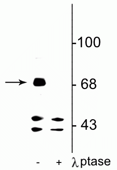 Western blot of rat hippocampal lysate showing specific immunolabeling of the ~71 kDa FMRP protein phosphorylated at Ser499 in the first lane (-). Phosphospecificity is shown in the second lane (+) where immunolabeling is completely eliminated by lysate treatment with lambda phosphatase (400 units/100uL lysate for 30 min). 