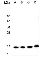 CPA2678-100ul | Rabbit Anti-SAP14 Polyclonal Antibody Biotrend