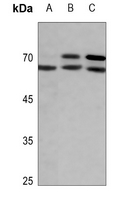 Western blot analysis of Lamin A/C (Phospho-S392) expression in DLD (A), mouse kidney (B), rat lung (C) whole cell lysates. (Predicted band size: 74 kD; Observed band size: 74; 65 kD)