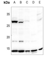Western blot analysis of Histone H2A expression in U87MG (A), A549 (B), SGC7901 (C), rat lung (D), mouse brain (E) whole cell lysates. (Predicted band size: 14 kD; Observed band size: 14 kD)