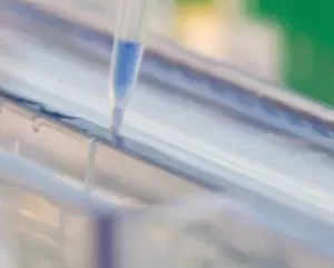 DNA Electrophoresis
