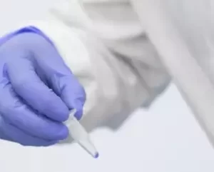 Sample Collection