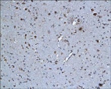 C5a staining in rat brain. Paraffin-embedded rat brain is stained with C5a Complement Antibody (Cat. No. 250565) used at 1:200 dilution.