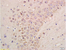 Substance P staining in rat liver. Formalin-fixed paraffin-embedded rat liver tissue is stained with Substance P Antibody (Cat. No. 250865) used at 1:200 dilution.