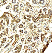 STAT3 staining in human breast. Paraffin-embedded human breast is stained with STAT3 Antibody (Cat. No. 251107) used at 1:200 dilution. 